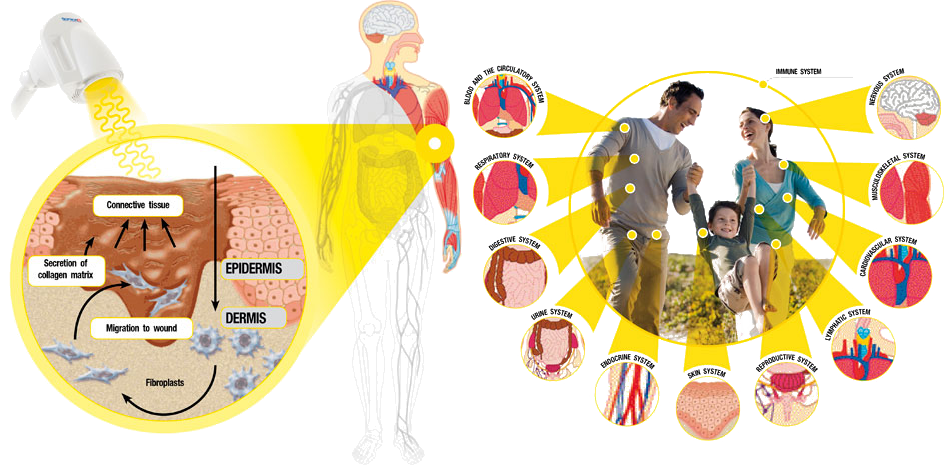 Bioptron Hyperlight - prikaz poti svetlobe od nepolarizirane do hiperpolarizirane Teslove kvantne torusne strukture